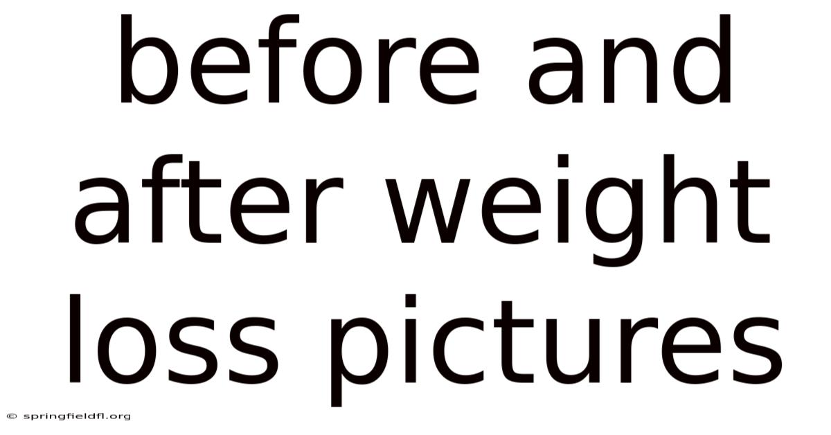 Before And After Weight Loss Pictures