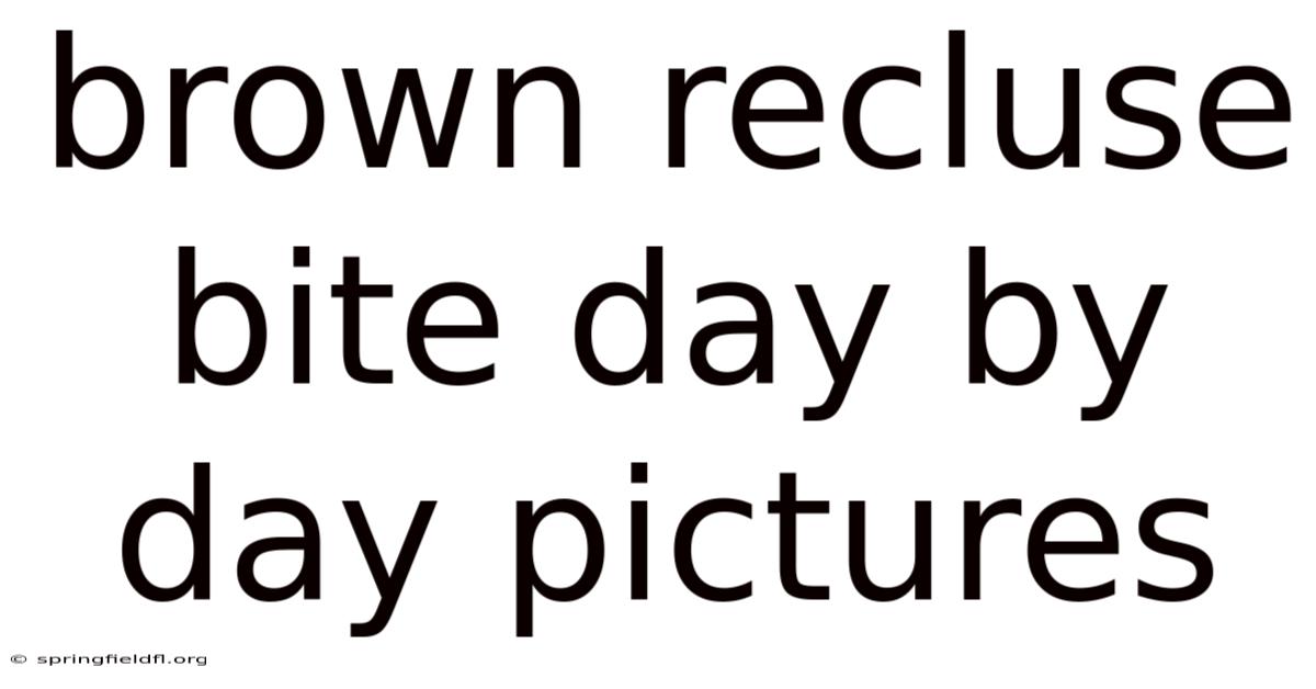 Brown Recluse Bite Day By Day Pictures