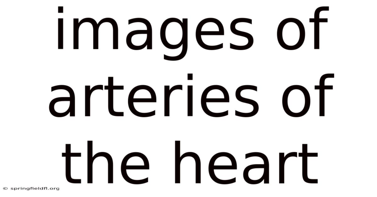 Images Of Arteries Of The Heart
