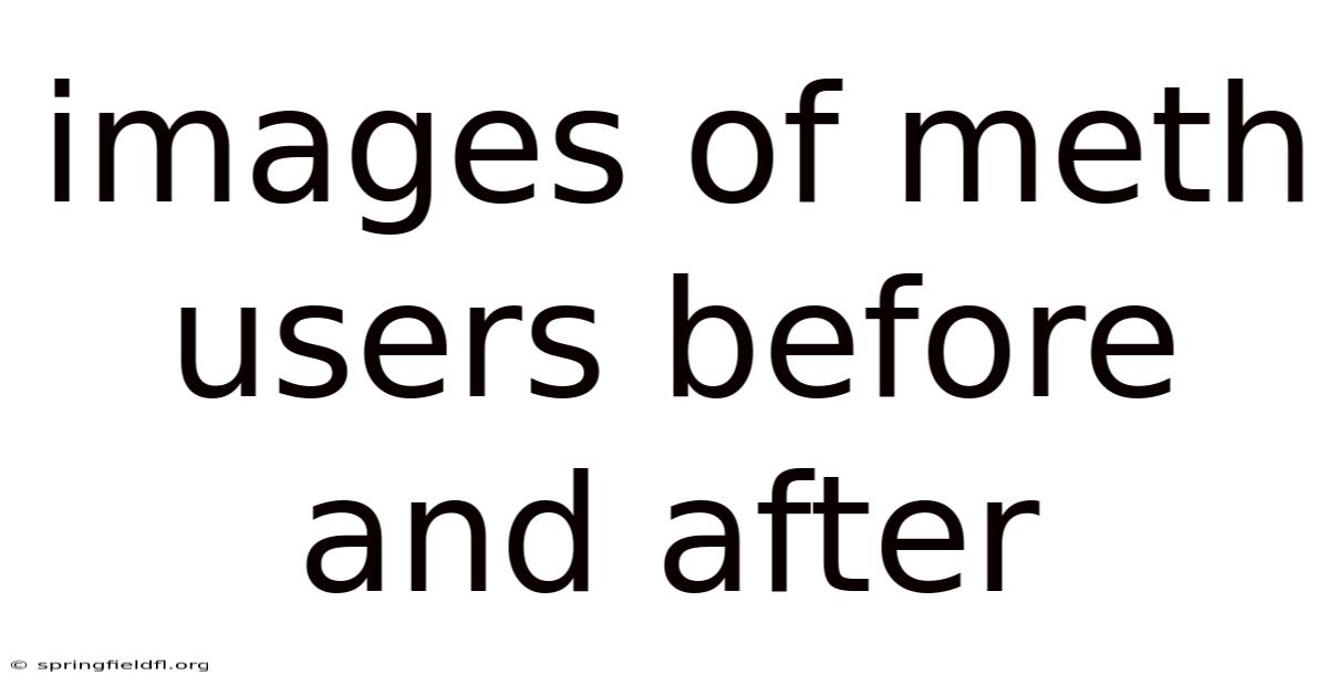 Images Of Meth Users Before And After