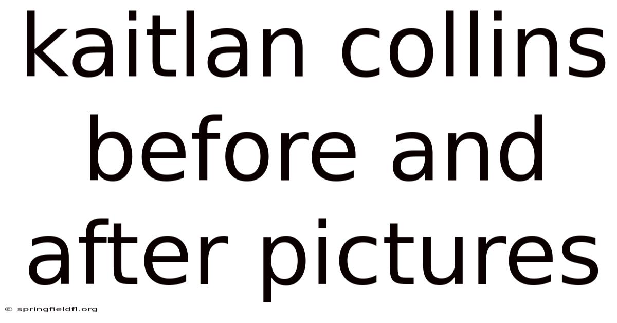 Kaitlan Collins Before And After Pictures