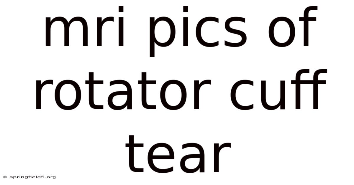 Mri Pics Of Rotator Cuff Tear
