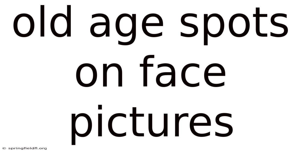 Old Age Spots On Face Pictures