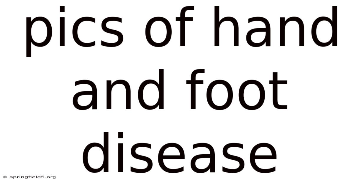 Pics Of Hand And Foot Disease