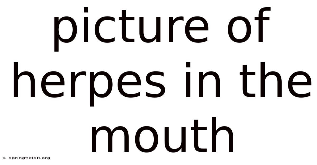 Picture Of Herpes In The Mouth