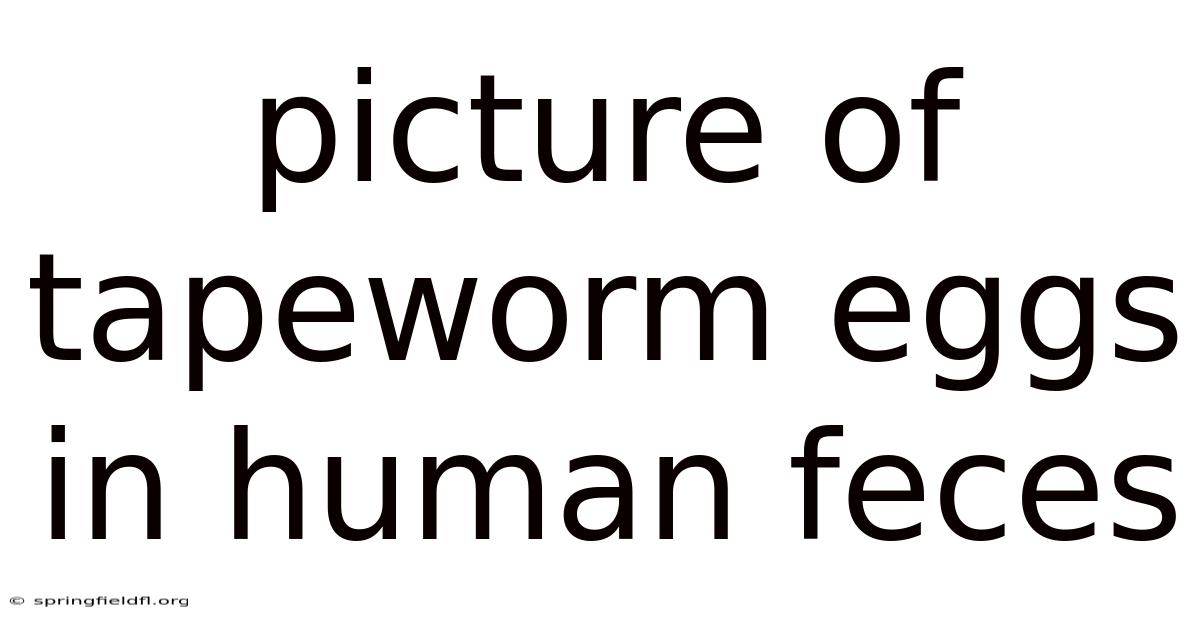 Picture Of Tapeworm Eggs In Human Feces
