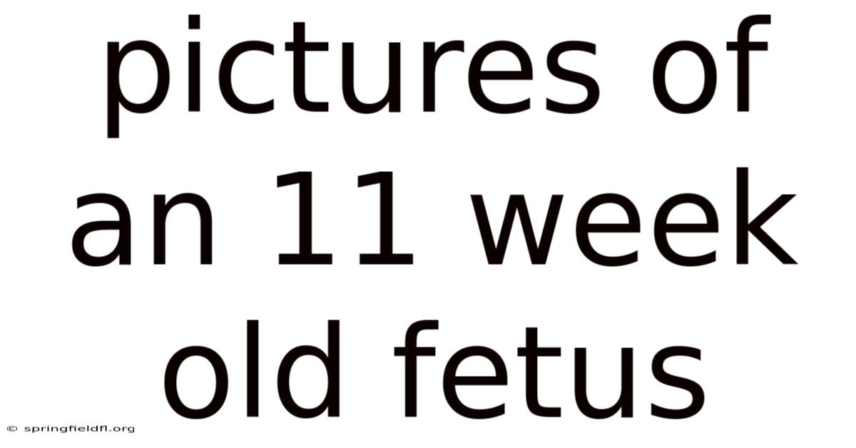 Pictures Of An 11 Week Old Fetus