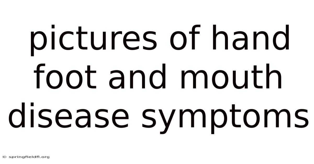 Pictures Of Hand Foot And Mouth Disease Symptoms