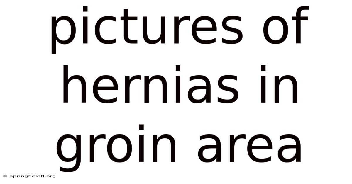 Pictures Of Hernias In Groin Area