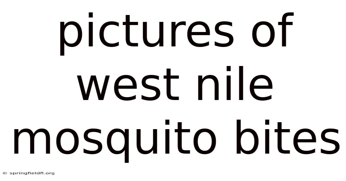 Pictures Of West Nile Mosquito Bites