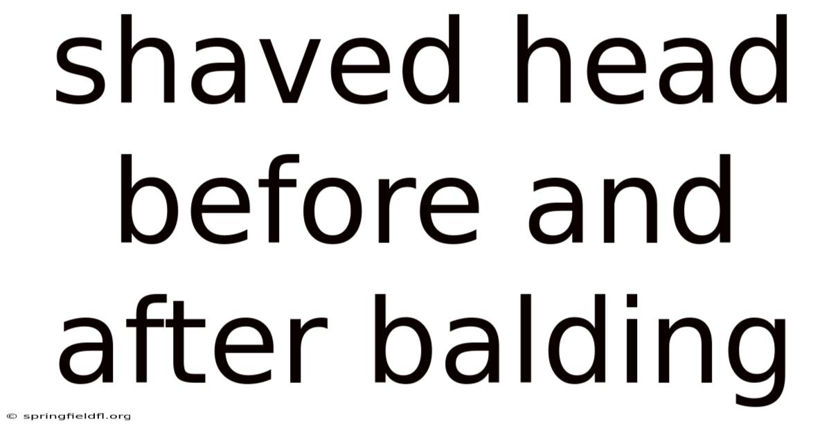 Shaved Head Before And After Balding