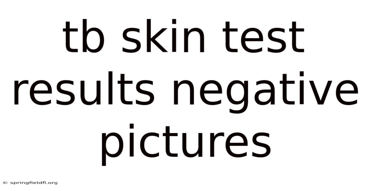 Tb Skin Test Results Negative Pictures