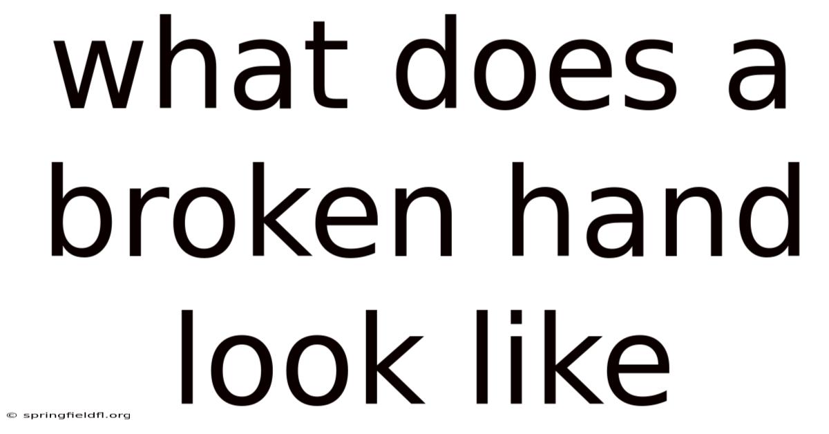What Does A Broken Hand Look Like