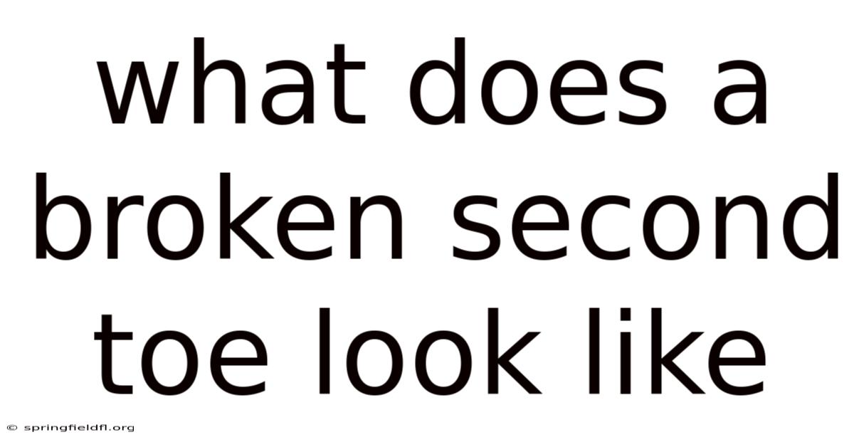 What Does A Broken Second Toe Look Like