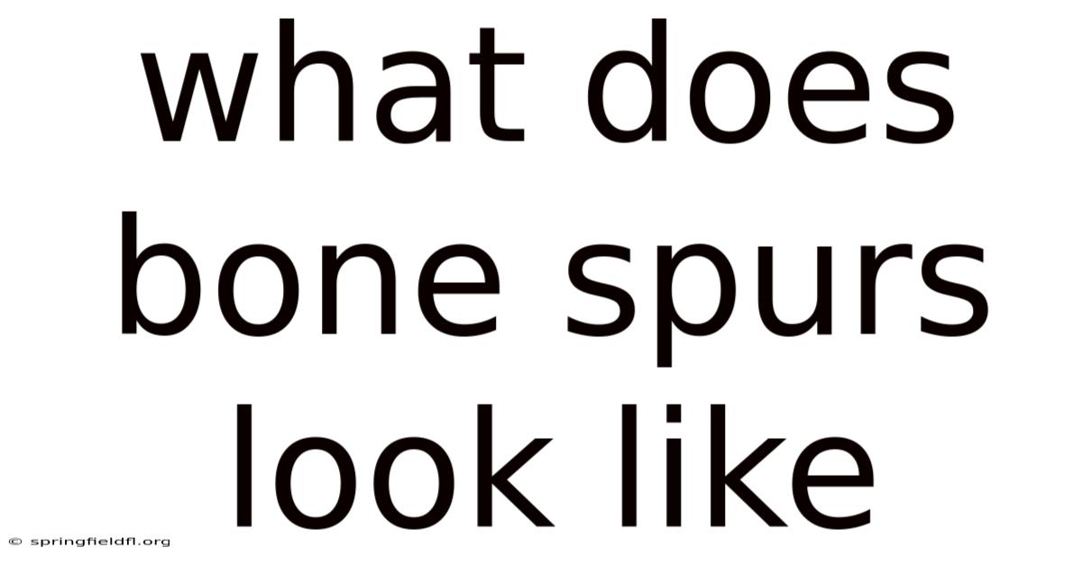 What Does Bone Spurs Look Like