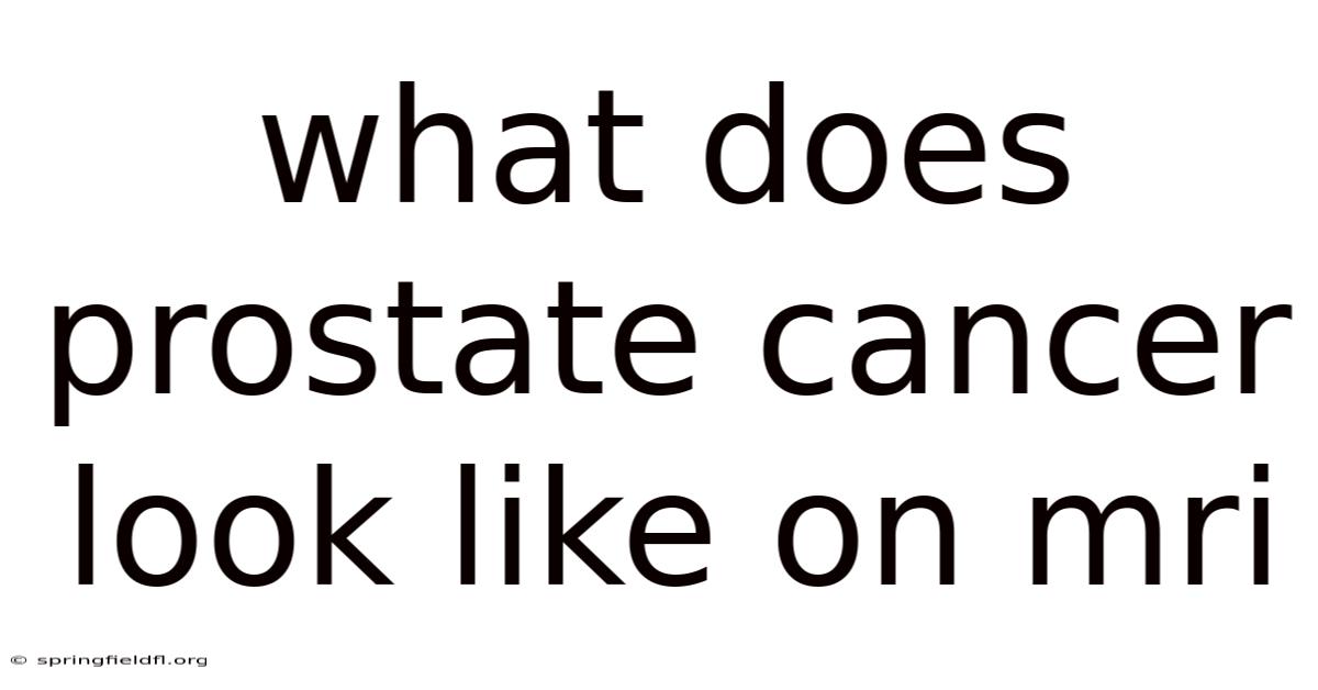 What Does Prostate Cancer Look Like On Mri