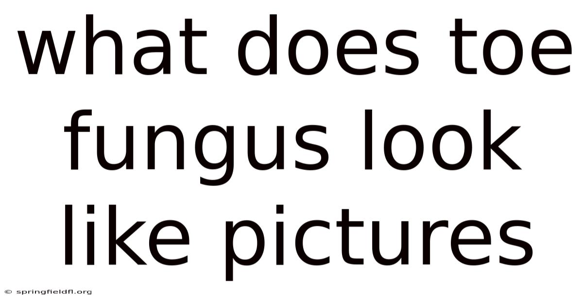 What Does Toe Fungus Look Like Pictures